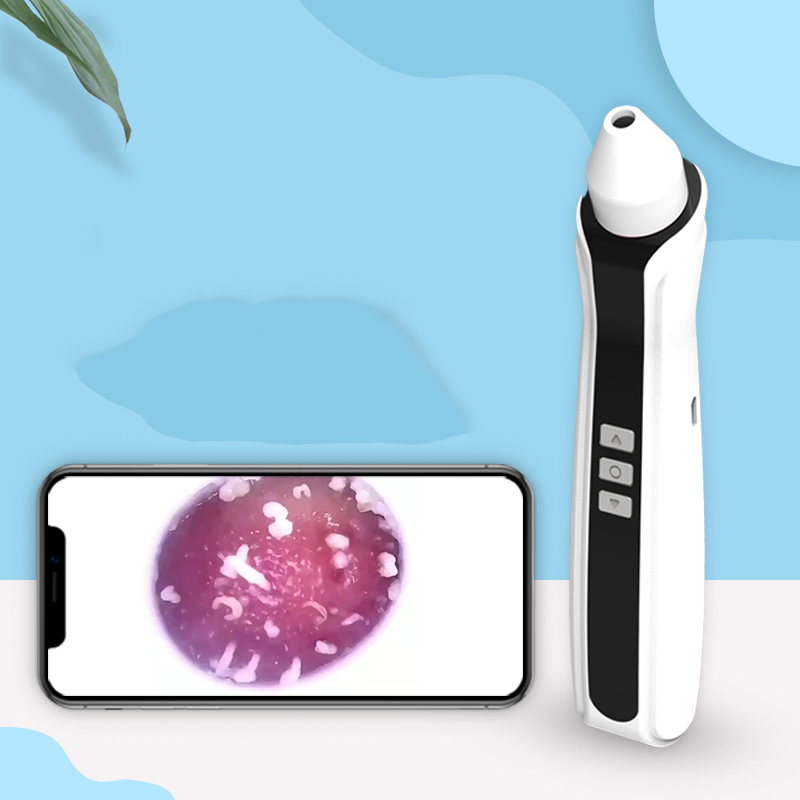 دستگاه میکرودرم دستگاه میکرودرم اسکن دار