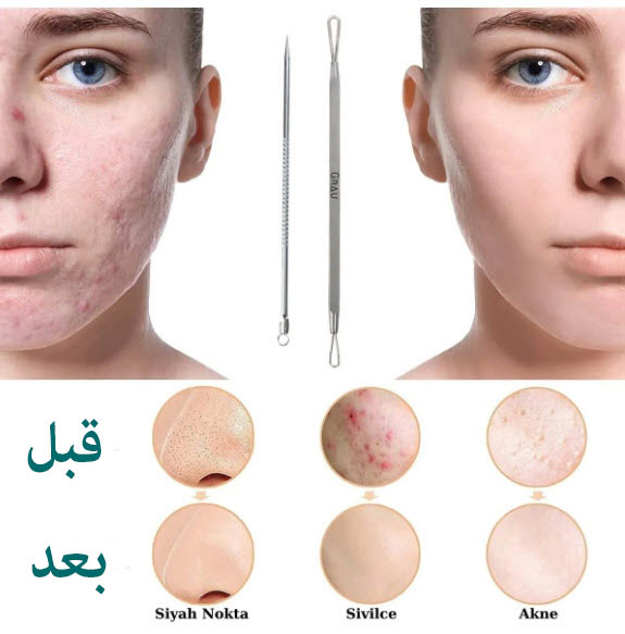 پک تیرکمدون